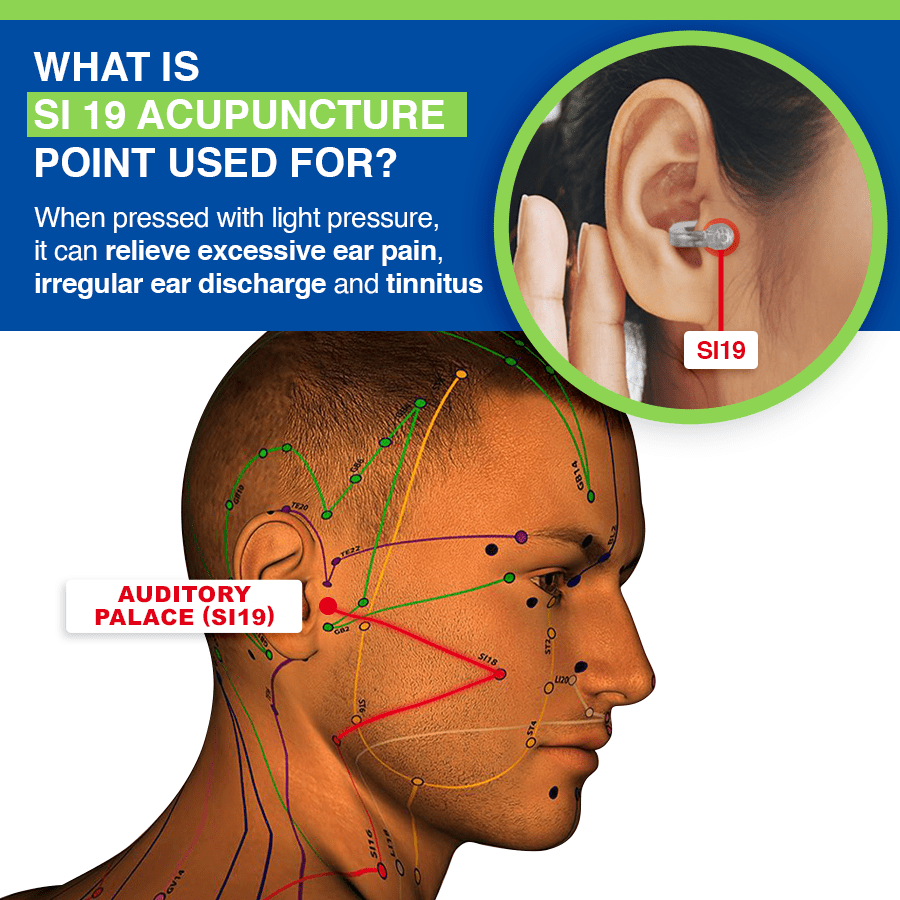 🎄🎄LUHAKA AcuPeace Tinnitus Relief Device✨✨